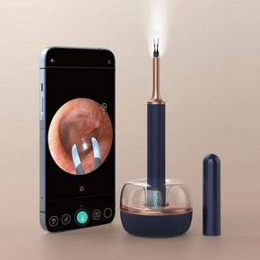 Bebird 비버드 이어스캐너 2022년 Note3 Pro Max 내시경 귀이개 귀청소 충전독 포함