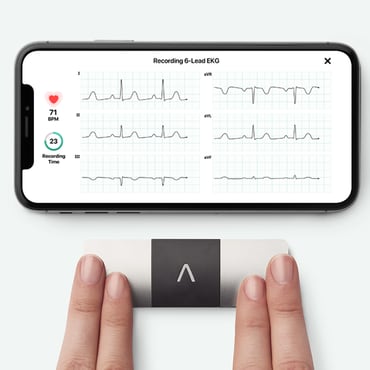 오므론 얼라이브코어 KardiaMobile 6L 심전도계 심전도 검사 부정맥 모니터