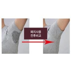 초슬림 겨드랑이땀패드 땀억제제 액취증