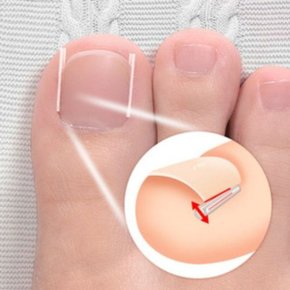 네성발톱 고정 팁 실리콘 와이어 발톱관리 보호기 10p_WEE8193