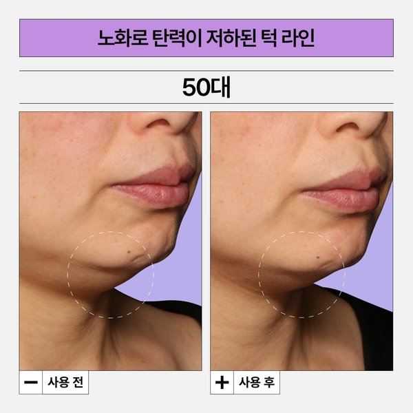 이미지4