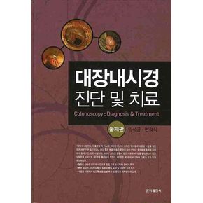 대장내시경 진단 및 치료