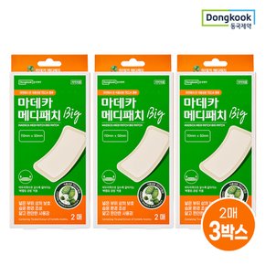 마데카 메디패치 빅 대형 2매 3개 (총 6매)