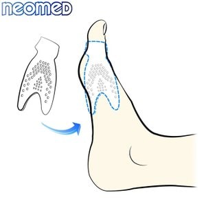 슈베이스 네오메드 엄지발가락 보호캡