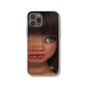 FRECKLE GIRL PHONE CASE