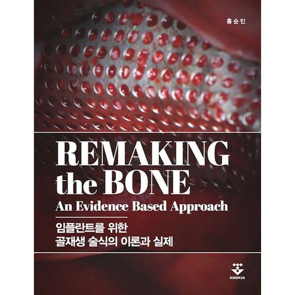 Remaking the bone(임플란트를 위한 골재생 술식의 이론과 실제)