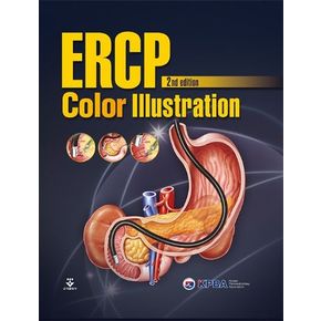 ERCP Color Illustration