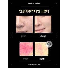 [예민 피부 집중 관리] 타겟티드™ 블래미쉬 토너 _하이드로 리빌드겔™ 미스트 100ml