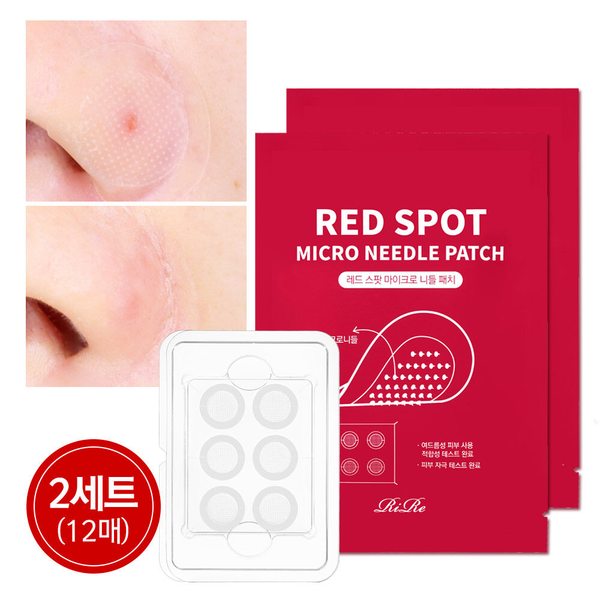 레드 스팟 마이크로 니들 여드름패치 2세트(12매)