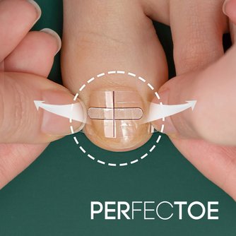 큐리풋 내성발톱교정기 내향성발톱 파고드는발톱 발톱파고들때 - HOME&SHOPPING 검색결과 >내성발톱교정, 이마트몰, 당신과 가장 가까운 이마트” style=”width:100%” title=”검색결과 >내성발톱교정, 이마트몰, 당신과 가장 가까운 이마트”><figcaption>검색결과 >내성발톱교정, 이마트몰, 당신과 가장 가까운 이마트</figcaption></figure>
<figure><img decoding=