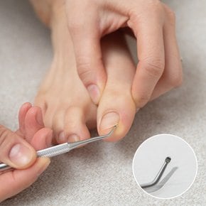 퍼펙토 2IN1 인그로운 발톱큐렛 파고드는 발톱 관리