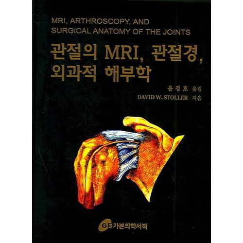 관절의 MRI 관절경 외과적 해부학