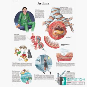 3B Scientific 천식 인체해부차트 VR1328 Asthma 천식차트 병원액자