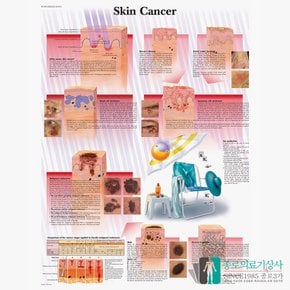 3B Scientific 피부과 피부암 병변 인체해부차트 VR1295 Skin Cancer 병원액자