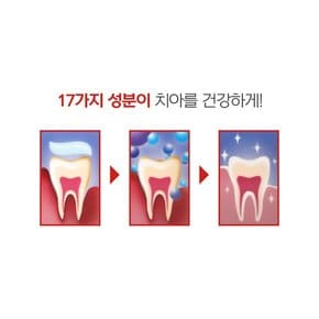 성원제약 시린이케어 치약 200g 치태제거 안티프라그 인산삼칼슘함유