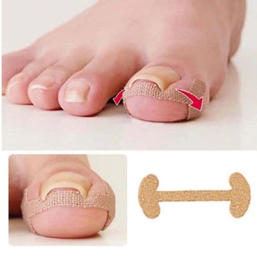내성발톱깍기' 최저가 검색, 최저가 5,200원 : 쿠차 | 시간을 줄여주는 쇼핑검색 검색결과 >내성발톱, 믿고 사는 즐거움 Ssg.Com” style=”width:100%” title=”검색결과 >내성발톱, 믿고 사는 즐거움 SSG.COM”><figcaption>검색결과 >내성발톱, 믿고 사는 즐거움 Ssg.Com</figcaption></figure>
<figure><img decoding=