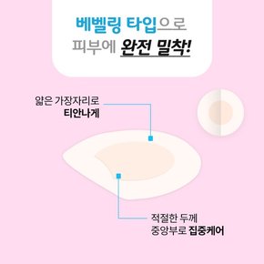 네오 맘스덤 뷰티스팟패치 원형 51매 습윤밴드 하이드로콜로이드 여드름패치