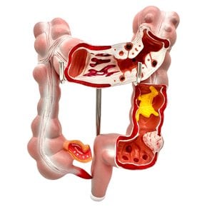 결장구조 결장모형 대장 직장 십이지장 항문 인체모형 J334