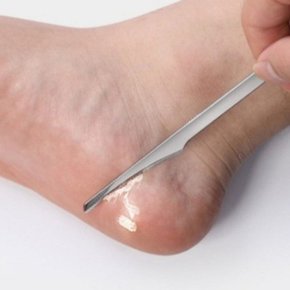 페디 각질 제거 나이프_WC81CD6