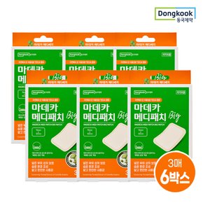 마데카 메디패치 빅 소형 3매 6개 (총 18매)